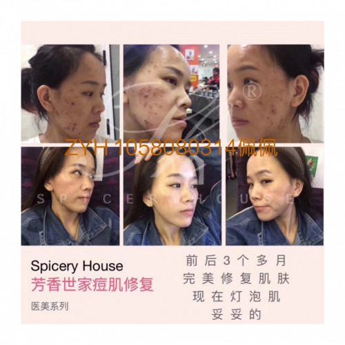 芳香世家产品效果